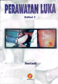 Perawatan Luka